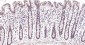 PI3-kinase p110 subunit beta Recombinant Rabbit mAb